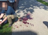 Atak groźnego psa. Zaatakowana kobieta w kałuży krwi! Zobacz zdjęcia