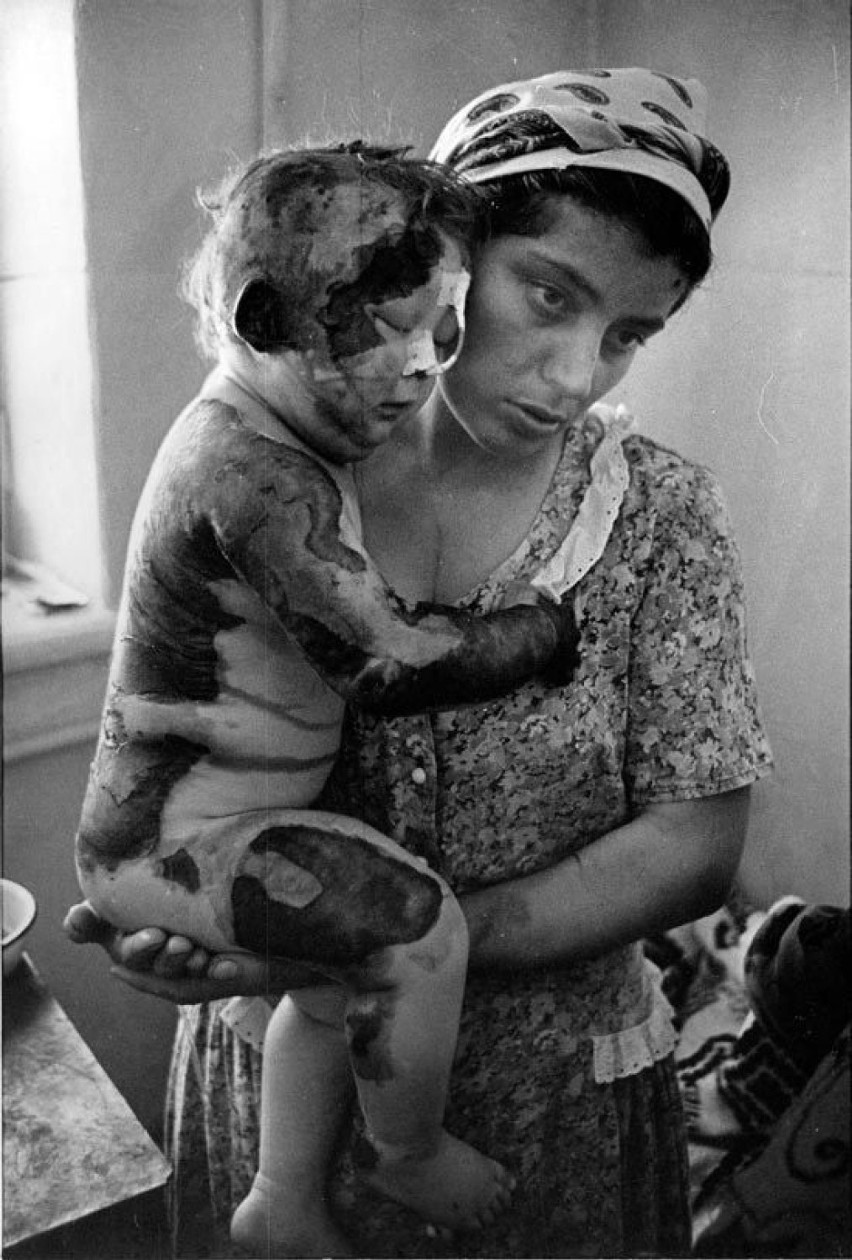 Cierpiąca czeczeńska matka ze swoim rannym dzieckiem...