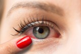 Po tych objawach rozpoznasz jęczmień na oku i zapalenie spojówek. Spuchnięta powieka i zaczerwienione oko mogą sygnalizować infekcję  