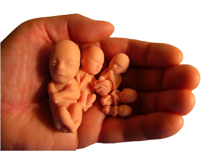 Aborcja i jej konsekwencje wciąż są jednym z głównym...