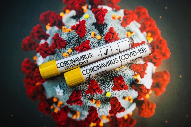 100 nowych zakażeń koronawirusem w regionie. W kraju ponad 5,7 tys. nowych przypadków COVID-19