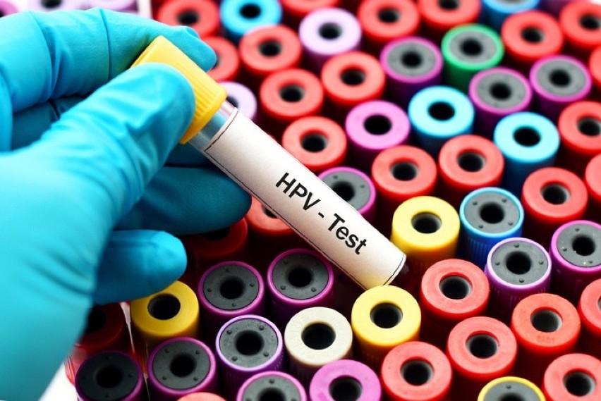 Zakażenie wirusem brodawczaka ludzkiego (HPV) może mieć...