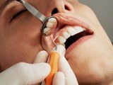 Ci dentyści w Świdniku są najlepsi! Tych stomatologów polecają pacjenci w naszym mieście