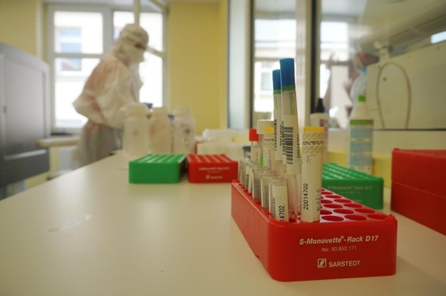 Punkty testowania w kierunku koronawirusa w Bydgoszczy - lista NFZ zaktualizowana 3 stycznia 2022 roku.