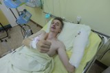 Anna Chrapusta z zespołem uratowali rękę Tadeusza Kosznika. Operacja trwała 9,5 godziny