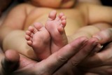 Wszystkie noworodki zbadają pod kątem SMA. Łódzkie jedno z pierwszych z badaniami przesiewowymi dzieci na rdzeniowy zanik mięśni