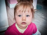 2-letnia Amelka Petryszyn wygląda słodko. Ale walczy z ciężką chorobą. Trwa zbiórka na walkę z zespołem Retta