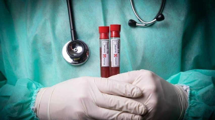 Wyniki badań laboratoryjnych potwierdziły zakażenie koronawirusem u 42 osób z powiatu pleszewskiego