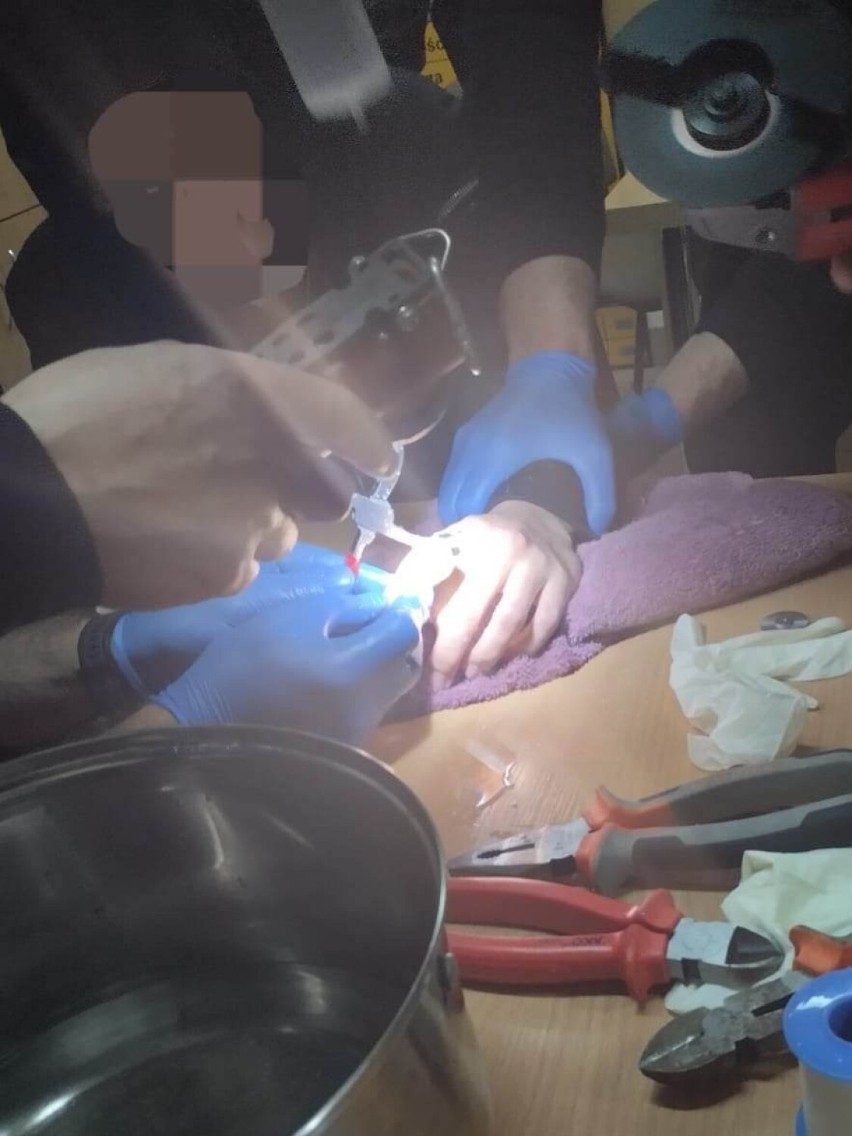 Strażacy z Jędrzejowa z chirurgiczną precyzją usuwali nastolatkowi stalowy pierścień 