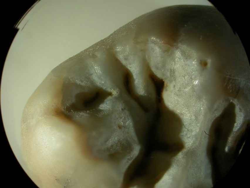 Ząb Neandertalczyka