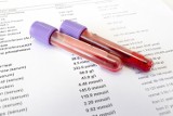 Gdzie zrobić badania krwi w Żywcu? TOP 11  laboratoriów medycznych i punktów pobrań 