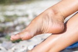 Fakty i mity na temat pielęgnacji stóp. Zobacz, co pomaga, a co szkodzi w utrzymaniu dobrej kondycji skóry nóg