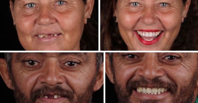Felipe Rossi to brazylijski stomatolog. Jednak zamiast zbijać kokosy w prywatnej klinice, leczy za darmo zęby ubogich ludzi, których nie stać na leczenie stomatologiczne. Zobaczcie na kolejnych slajdach, jak niesamowitą zmianę w wyglądzie funduje wyleczenie zębów!