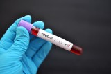 Coraz mniej testów na koronawirusa w Polsce. Dlaczego wskaźnik testowania znów spadł? 