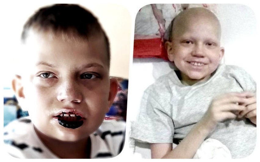 1-letni Krzysiu Antczak, uczeń szkoły w Grzybowie, walczy o życie. Chłopiec boryka się z ostrą białaczką limfoblastyczną - możemy pomóc!