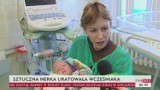 Lekarze z Legnicy uratowali noworodka dzięki sztucznej nerce. Pierwszy taki zabieg na świecie