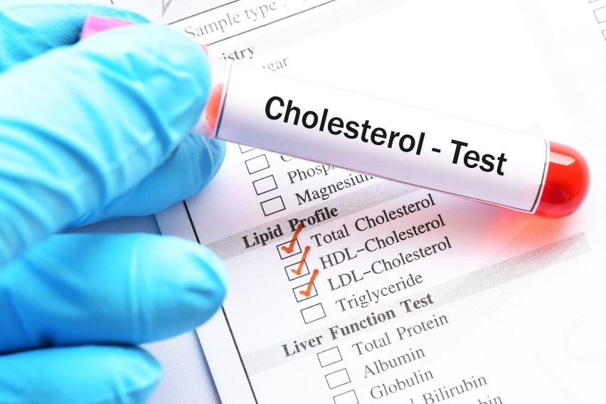 Zalecany maksymalny poziom cholesterolu we krwi zależy od...