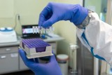 Eksperci alarmują: Jest za mało testów na koronawirusa! Tak nie opanujemy epidemii