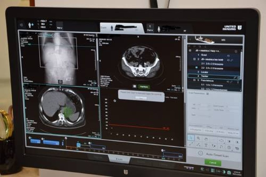 Nowy tomograf w Szpitalu Powiatowym w Myszkowie 