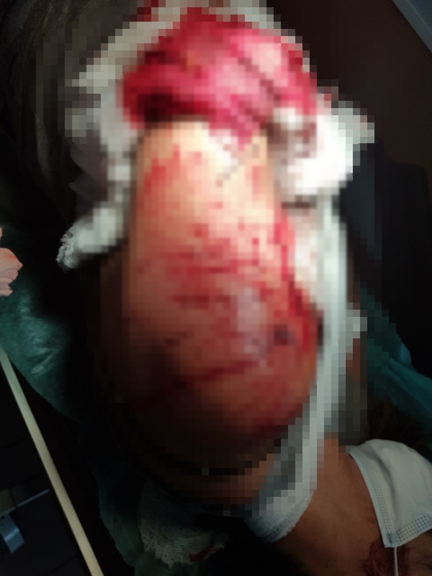 Agresywny pies zaatakował kobietę.