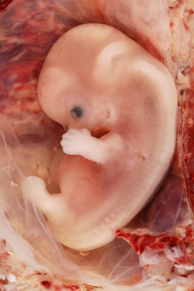 http://pl.wikipedia.org/w/index.php?title=Plik:9-Week_Human_Embryo_from_Ectopic_Pregnancy.jpg&filetimestamp=20070614203143