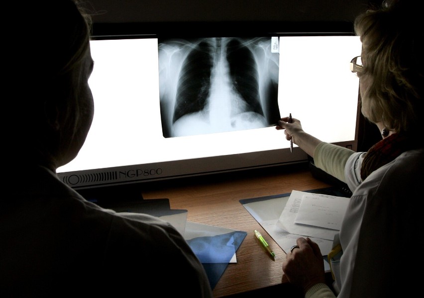 Na Dolnym Śląsku ruszył program profilaktyki raka płuc....