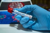 7 zgonów i 86 nowych przypadków koronawirusa w Polsce. 4 w Kujawsko-Pomorskiem - najnowsze dane z miast i powiatów [10 lipca 2021]