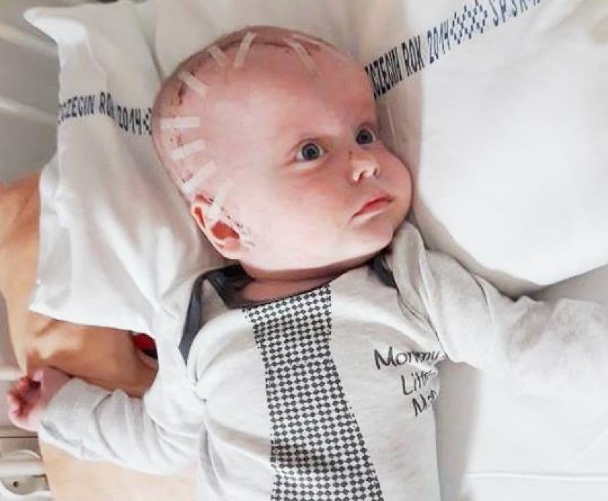 Leśna Jania. Chłopiec ma zaledwie 11 miesięcy i cierpi na guza mózgu. Choroba odebrała mu wzrok
