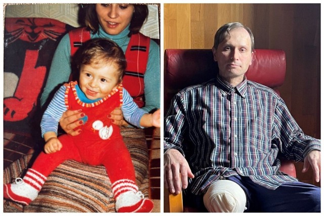 Paweł Besbir z Nowego Sącza choruje na rzadką chorobę genetyczną. 44-latek urodził się zdrowy, ale radość jego rodziców Bogumiły i Macieja nie trwała długo