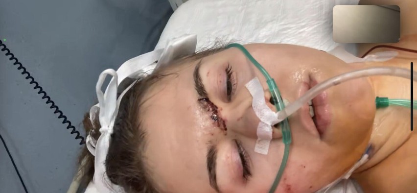 Została ciężko ranna w wypadku samochodowym w Czapielsku (gm. Kolbudy). Ruszyła zbiórka na pomoc dla 18-letniej Nikoli