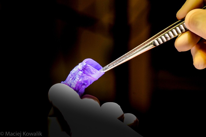 Specjaliści z GUMed badają bioimplanty z nanocelulozy. Sukces gdańskich naukowców 