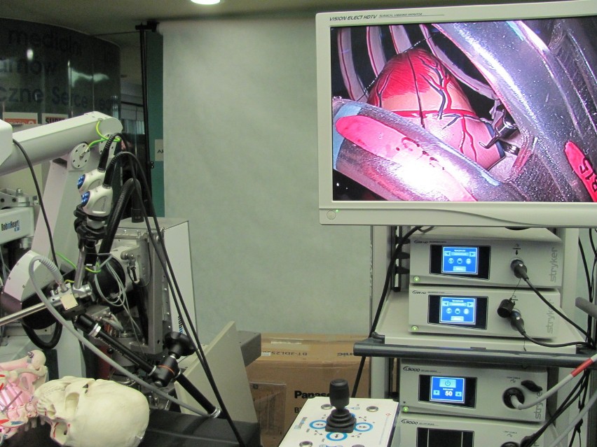 Zabrze: Międzynarodowa konferencja &quot;Roboty Medyczne 2012&quot; w Fundacji Rozwoju Kardiochirurgii [WIDEO]