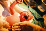 Do trzech bydgoskich porodówek trafi nowy sprzęt