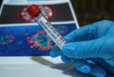 W Gorlicach można  wykonać test polegający na oznaczeniu obecności przeciwciał IgM i IgG specyficznych dla koronawirusa