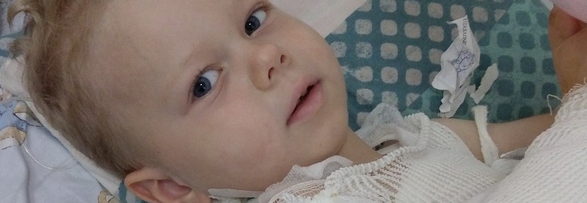 Dajcie szansę Alankowi na nowe życie- apelują rodzice poparzonego 4-latka [zdjęcia]