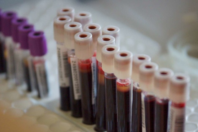 Akcja krwiodawstwa w Kaliszu. Wydział Pedagogiczno-Artystyczny zaprasza krwiodawców