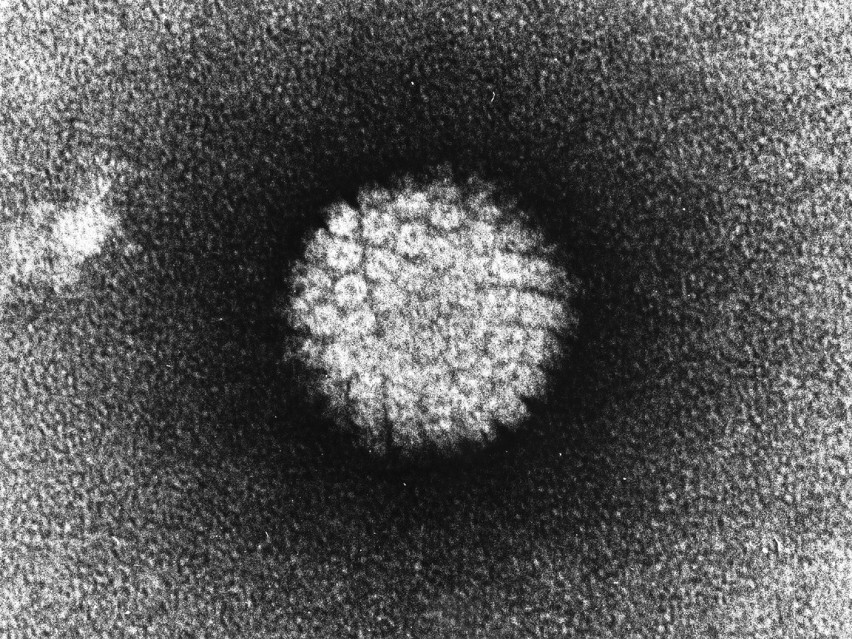 Do grupy tej należą wirusy brodawczaka ludzkiego - HPV. W...