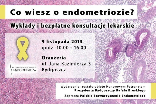 Endometrioza - konsultacje lekarskie.