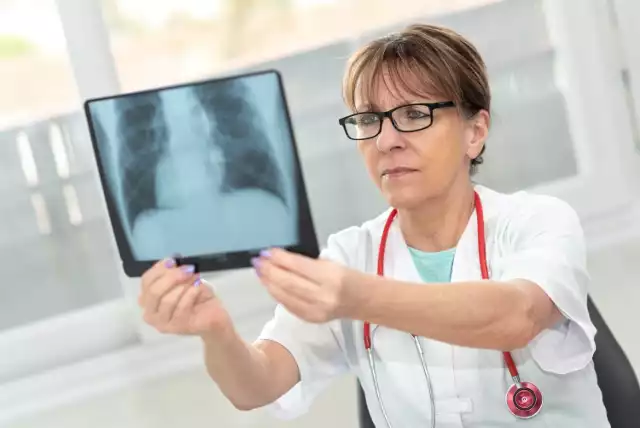 U pacjentów z POChP należy regularnie wykonywać RTG płuc, aby sprawdzić poziom uszkodzeń miąższu narządów.