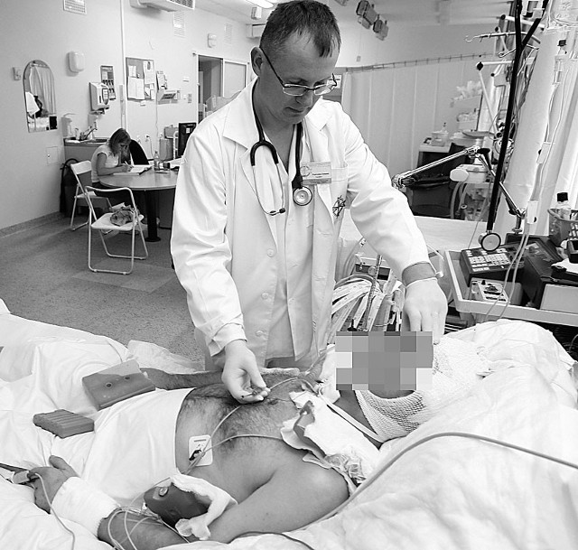 Dr Przemysław Dobielski bada ciężko rannego 21-letniego mężczyznę, który przebywa na oddziale intensywnej terapii w szpitalu im. WAM.