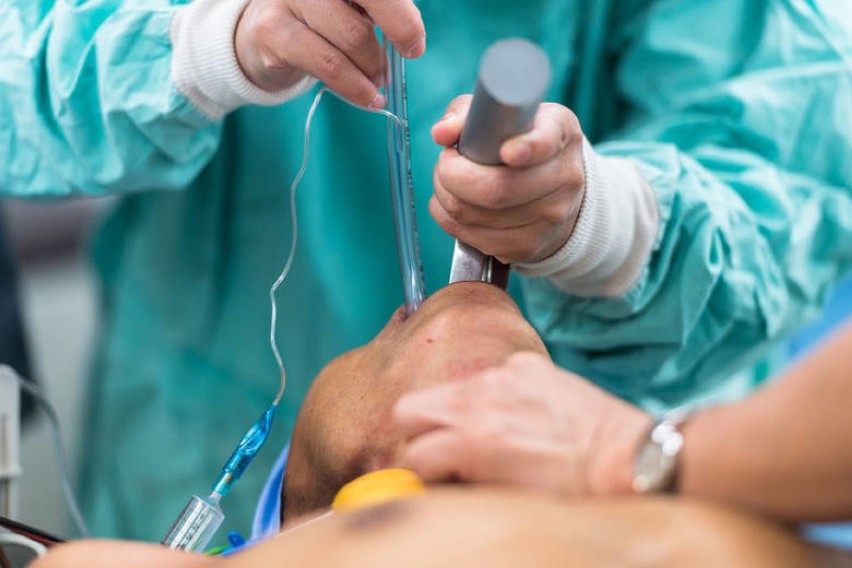 Jak działa respirator? Jest mocno inwazyjny, powoduje odleżyny, zwężenie tchawicy, ale często to jedyna metoda, by uratować komuś życie