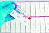 Malborski sanepid zachęca do wykonywania badań wykrywających wirusa HCV