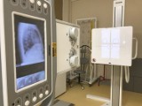 W Szpitalu Powiatowym w Międzychodzie został zainstalowany nowoczesny aparat RTG, który może wykonywać zdjęcia w technologii cyfrowej