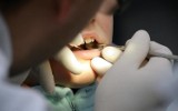 Wodzisław Śląski: Blisko 2500 zarzutów dla dentysty, który leczył zęby fikcyjnym pacjentom i wyłudzał pieniądze od NFZ 
