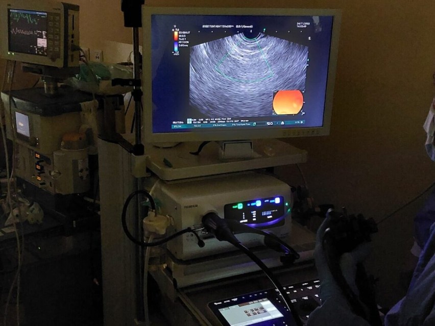 Nowe urządzenie łączy badania  ultrasonografii z endoskopią.