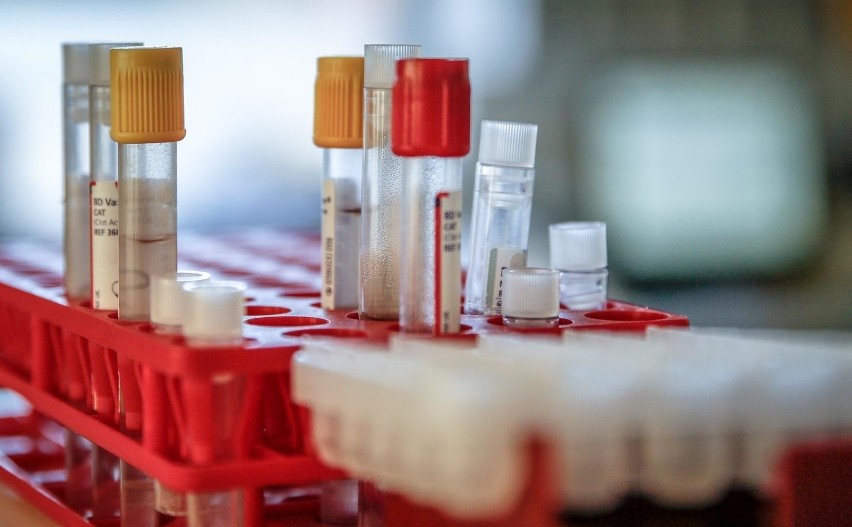 Invicta wykonuje testy na obecność koronawirusa. Może osiągnąć poziom 2  tys. testów na dobę.Tak wygląda praca w laboratorium [ZDJĘCIA] | Gdańsk  Nasze Miasto