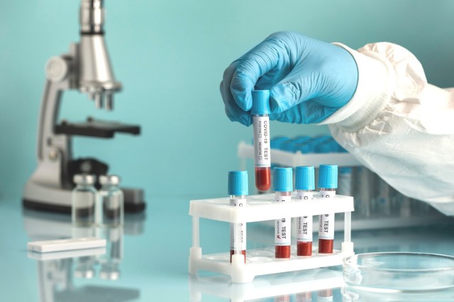 Test opracowany przez polskich naukowców oparty jest o metodę PCR i  wykorzystuje jedynie dwa geny. Ma on za zadanie identyfikować osoby o szczególnej predyspozycji do ciężkiego przebiegu COVID-19.