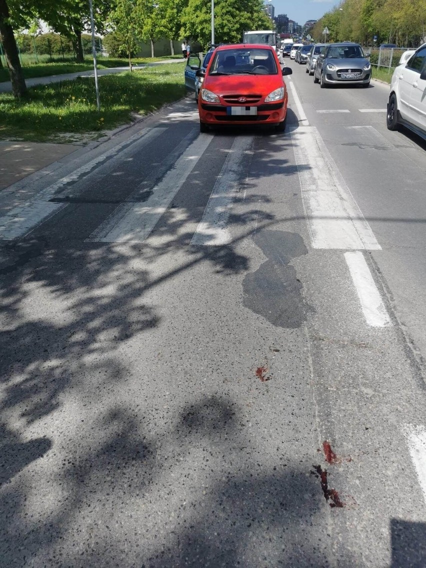 Wypadek w Kielcach. Starsza pani potrącona na pasach