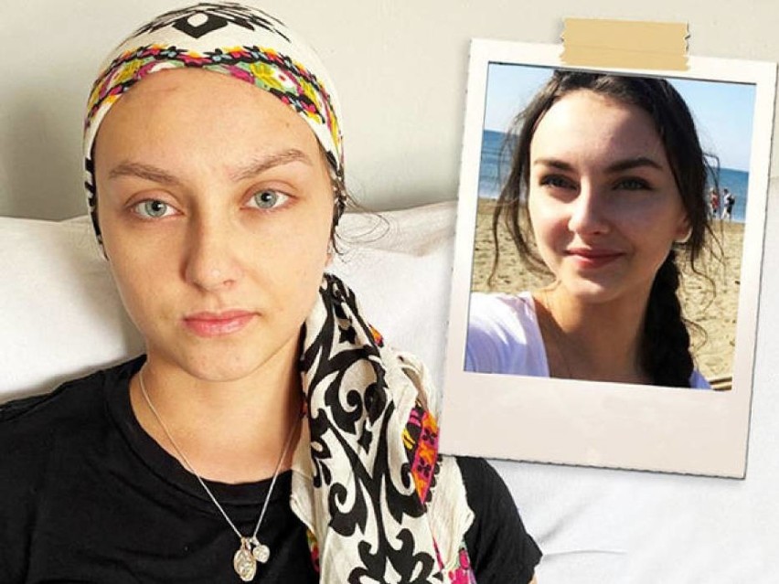 18-letnia Julia Kuczała walczy z guzem mózgu