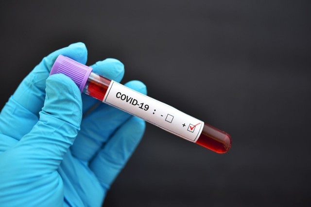 Zestawienie danych dotyczących koronawirusa we wtorek, 11 listopada 2020 roku.